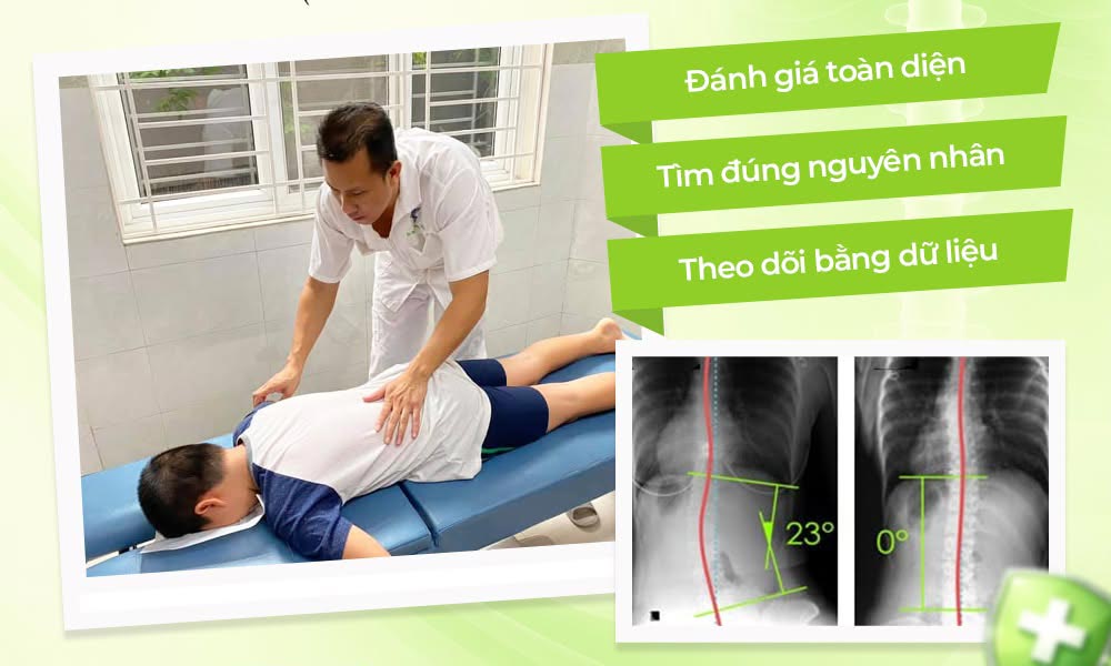 Tái huấn luyện (SET)